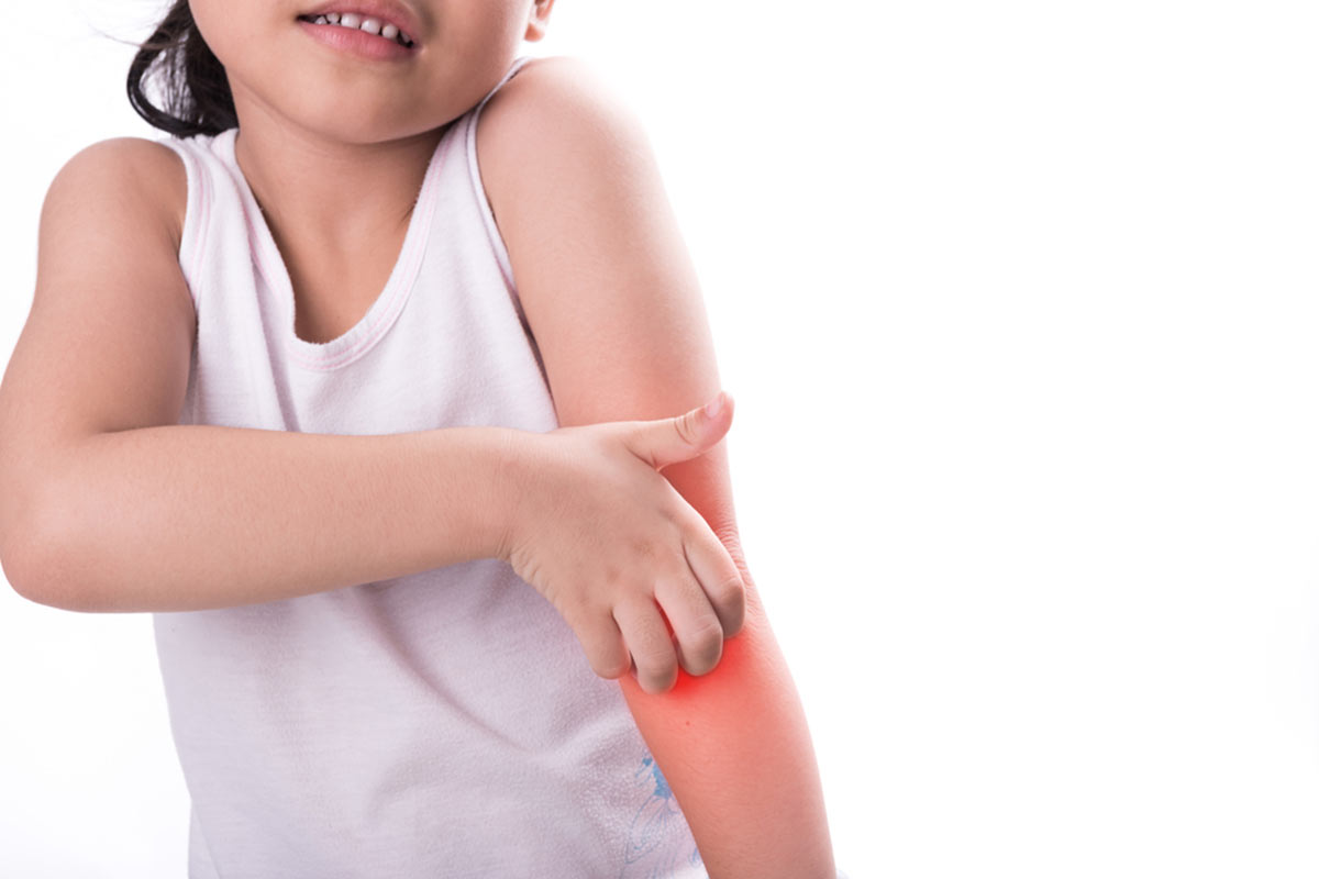 آشنایی با انواع حساسیت های پوستی در کودکان