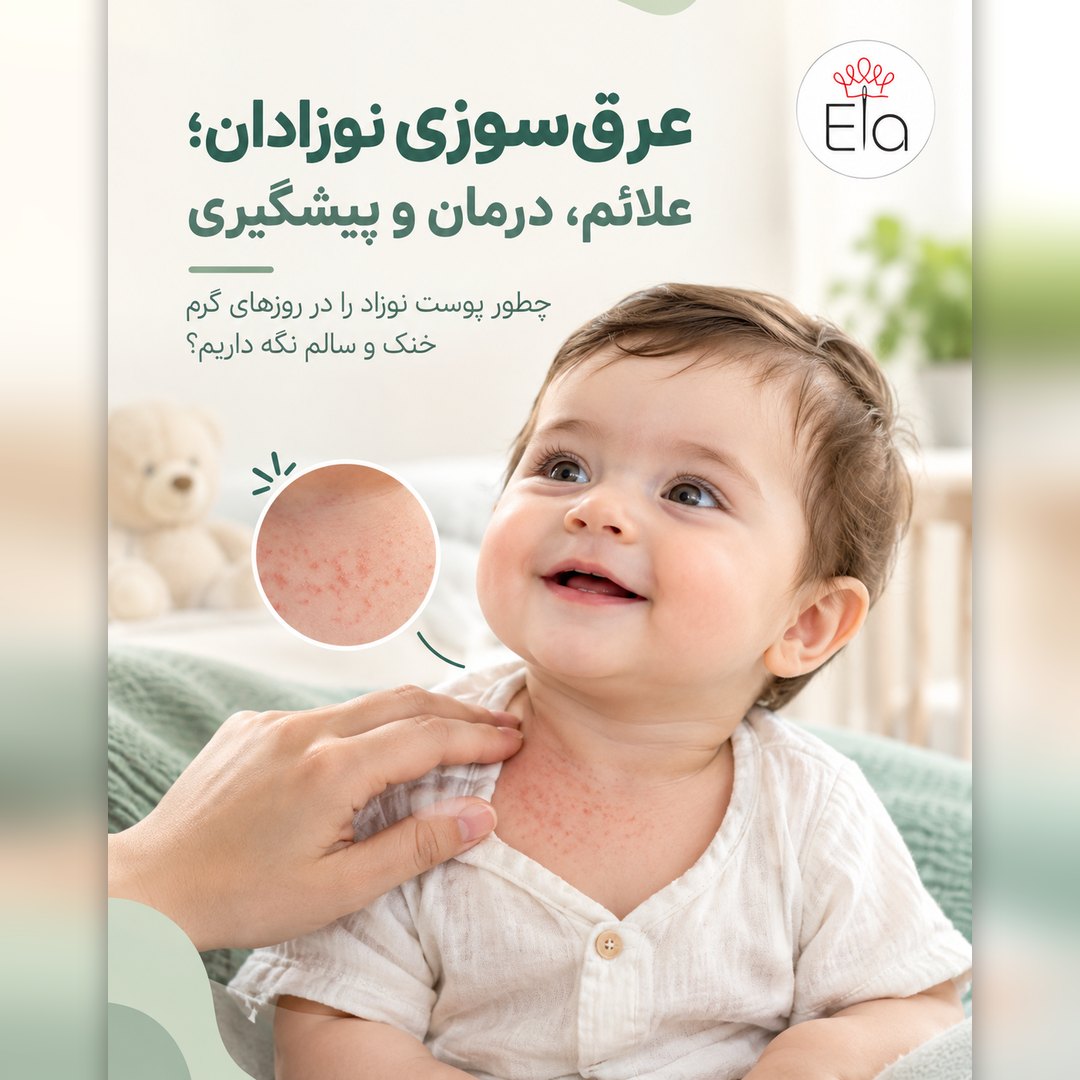 عرق سوزی نوزاد؛ پوستر الا با کودک خندان و دانه‌های ریز قرمز روی گردن و سینه